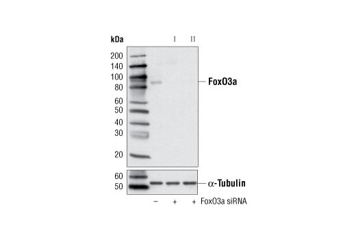 Western blot analysis of extracts from HeLa cells, transfected with 100 nM SignalSilence ® Control siRNA (Unconjugated) #6568 (-), SignalSilence ® FoxO3a siRNA I #6302 (+) or SignalSilence ® FoxO3a siRNA II (+), using FoxO3a (75D8) Rabbit mAb #2497 (upper) or α-Tubulin (11H10) Rabbit mAb #2125 (lower). The FoxO3a (75D8) Rabbit mAb confirms silencing of FoxO3a expression, while the α-Tubulin (11H10) Rabbit mAb is used as a loading control.