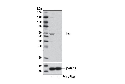 Western blot analysis of extracts from 293T cells, transfected with 100 nM SignalSilence ® Control siRNA (Unconjugated) #6568 (-) or SignalSilence ® Fyn siRNA I (+), using Fyn Antibody #4023 (upper) or β-Actin (D6A8) Rabbit mAb #8457 (lower). The Fyn Antibody confirms silencing of Fyn expression, while the β-Actin (D6A8) Rabbit mAb is used as a loading control.