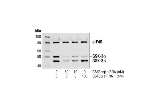 Western blot analysis of extracts from HeLa cells, untransfected or transfected with either GSK-3alpha/beta siRNA or GSK-3alpha siRNA. GSK-3alpha and GSK-3beta were detected using a GSK-3alpha/beta antibody, and eIF4B was detected using eIF4B Antibody #3592. The GSK-3alpha/beta antibody confirms silencing of GSK-3alpha and beta expression, and the eIF4B Antibody is used to control for loading and siRNA specificity.