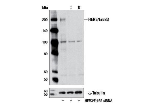 Western blot analysis of extracts from OVCAR8 cells, transfected with 100 nM SignalSilence ® Control siRNA (Unconjugated) #6568 (-), SignalSilence ® HER3/ErbB3 siRNA I (+) or SignalSilence ® HER3/ErbB3 siRNA II #6422 (+), using HER3/ErbB3 (1B2E) Rabbit mAb #4754 (upper) or α-Tubulin (11H10) Rabbit mAb #2125 (lower). The HER3/ErbB3 (1B2E) Rabbit mAb confirms silencing of HER3/ErbB3 expression, while the α-Tubulin (11H10) Rabbit mAb is used as a loading control.