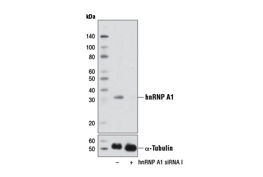 Western blot analysis of extracts from HeLa cells, transfected with 100 nM SignalSilence ® Control siRNA (Unconjugated) #6568 (-) or SignalSilence ® hnRNP A1 siRNA I (+), using hnRNP A1 (D21H11) Rabbit mAb #8443 and α-Tubulin (11H10) Rabbit mAb #2125. The hnRNP A1 (D21H11) Rabbit mAb confirms silencing of hnRNP A1 expression, while the α-Tubulin (11H10) Rabbit mAb is used as a loading control.