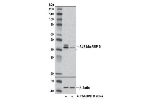 Western blot analysis of extracts from 293T cells, transfected with 100 nM SignalSilence ® Control siRNA (Unconjugated) #6568 (-) or SignalSilence ® AUF1/hnRNP D siRNA I (+), using AUF1/hnRNP D (D6O4F) Rabbit mAb #12382 (upper) or β-Actin (D6A8) Rabbit mAb #8457 (lower). The AUF1/hnRNP D (D6O4F) Rabbit mAb confirms silencing of AUF1/hnRNP D expression, while the β-Actin (D6A8) Rabbit mAb is used as a loading control.