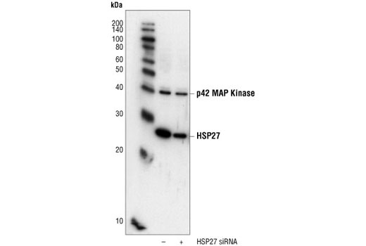 Western blot analysis of extracts from HeLa cells transfected with 100 nM SignalSilence ® Control siRNA (Fluorescein Conjugate) #6201 (-) or HSP27 siRNA I (+), using HSP27 (G31) Mouse mAb #2402 and p44/42 MAPK (Erk1/2) (3A7) Mouse mAb #9107. The HSP27 (G31) mAb confirms silencing of HSP27 expression and p44/42 MAPK mAb is used to control for loading and specificity of HSP27 siRNA.