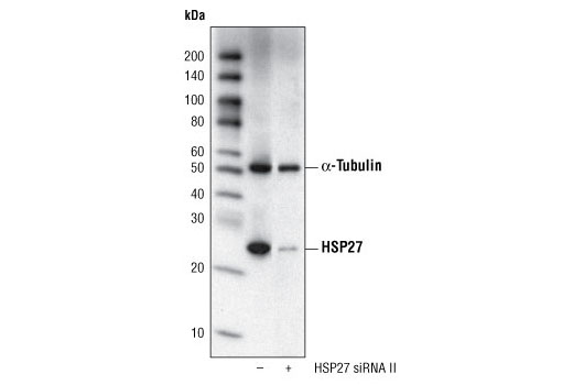Western blot analysis of extracts from HeLa cells, transfected with 100 nM SignalSilence ® Control siRNA (Fluorescein Conjugate) #6201 (-) or SignalSilence ® HSP27 siRNA II #6526 (+), using HSP27 (G31) Mouse mAb #2402 and α-Tubulin (11H10) Rabbit mAb #2125. HSP27 (G31) Mouse mAb confirms silencing of HSP27 expression, while α-Tubulin (11H10) Rabbit mAb is used to control for loading and specificity of HSP27 siRNA.