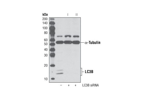 Western blot analysis of extracts from HeLa cells, transfected with 100 nM SignalSilence ® Control siRNA (Unconjugated) #6568 (-), SignalSilence ® LC3B siRNA I #6212 (+) or SignalSilence ® LC3B siRNA II (+), using LC3B (D11) XP ® Rabbit mAb #3868 and α-Tubulin (11H10) Rabbit mAb #2125. The LC3B (D11) XP ® Rabbit mAb confirms silencing of LC3B expression, while the α-Tubulin (11H10) Rabbit mAb is used to control for loading and specificity of LC3B siRNA.