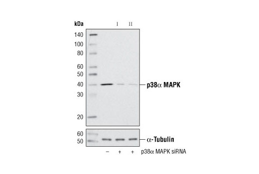 Western blot analysis of extracts from 293 cells, transfected with 100 nM SignalSilence ® Control siRNA (Unconjugated) #6568 (-), SignalSilence ® p38α MAPK siRNA I #6269 (+) or SignalSilence ® p38α MAPK siRNA II (+), using p38α MAPK Antibody #9218 (upper) or α-Tubulin (11H10) Rabbit mAb #2125 (lower). The p38α MAPK Antibody confirms silencing of p38α MAPK expression, while the α-Tubulin (11H10) Rabbit mAb is used as a loading control.