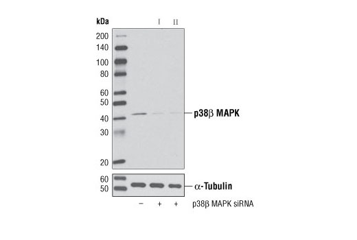 Western blot analysis of extracts from 293 cells, transfected with 100 nM SignalSilence ® Control siRNA (Unconjugated) #6568 (-), SignalSilence ® p38β MAPK siRNA I #6278 (+) or SignalSilence ® p38β MAPK siRNA II (+), using p38β MAPK (C28C2) Rabbit mAb #2339 (upper) or α-Tubulin (11H10) Rabbit mAb #2125 (lower). The p38β MAPK (C28C2) Rabbit mAb confirms silencing of p38β MAPK expression, while the α-Tubulin (11H10) Rabbit mAb is used as a loading control.