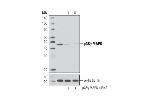 Western blot analysis of extracts from 293 cells, transfected with 100 nM SignalSilence ® Control siRNA (Unconjugated) #6568 (-), SignalSilence ® p38γ MAPK siRNA I (+) or SignalSilence ® p38γ MAPK siRNA II #6633 (+), using p38γ MAPK Antibody #2307 (upper) or α-Tubulin (11H10) Rabbit mAb #2125 (lower). The p38γ MAPK Antibody confirms silencing of p38γ MAPK expression, while the α-Tubulin (11H10) Rabbit mAb is used as a loading control.