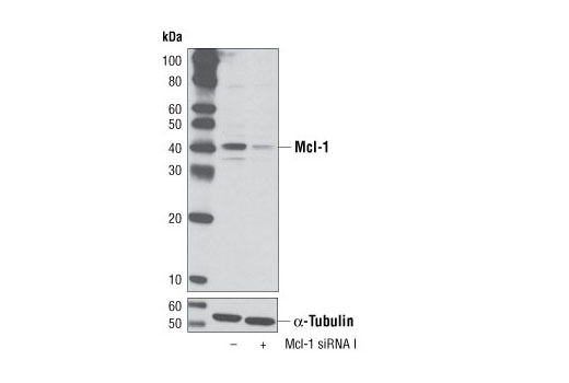 Western blot analysis of extracts from HeLa cells, transfected with 100 nM SignalSilence ® Control siRNA (Unconjugated) #6568 (-) or SignalSilence ® Mcl-1 siRNA I (+), using Mcl-1 (D35A5) Rabbit mAb #5453 (upper) or α-Tubulin (11H10) Rabbit mAb #2125 (lower). The Mcl-1 (D35A5) Rabbit mAb confirms silencing of Mcl-1 expression, while the α-Tubulin (11H10) Rabbit mAb is used as a loading control.