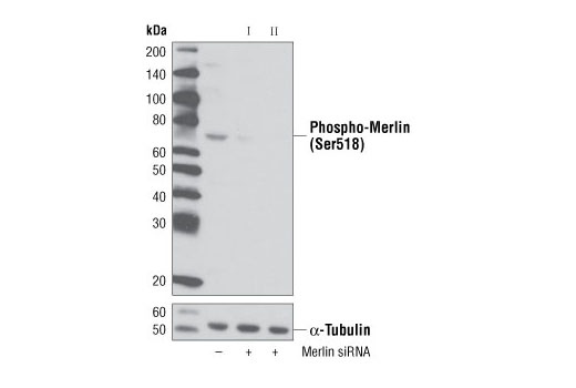 Western blot analysis of extracts from PC3 cells, transfected with 100 nM SignalSilence ® Control siRNA (Unconjugated) #6568 (-), SignalSilence ® Merlin siRNA I (+) or SignalSilence ® Merlin siRNA II #6338 (+), using Phospho-Merlin (Ser518) Antibody #9163 (upper) or α-Tubulin (11H10) Rabbit mAb #2125 (lower). The Phospho-Merlin (Ser518) Antibody confirms silencing of Merlin expression, while the α-Tubulin (11H10) Rabbit mAb is used as a loading control.