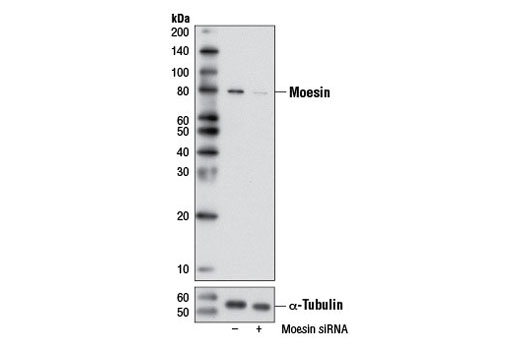 Western blot analysis of extracts from HeLa cells, transfected with 100 nM SignalSilence ® Control siRNA (Unconjugated) #6568 (-) or SignalSilence ® Moesin siRNA I (+), using Moesin (Q480) Antibody #3150 and α-Tubulin (11H10) Rabbit mAb #2125. The Moesin (Q480) Antibody confirms silencing of moesin expression, while the α-Tubulin (11H10) Rabbit mAb is used as a loading control.