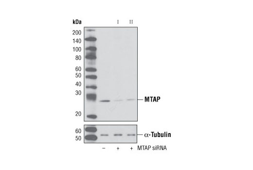 Western blot analysis of extracts from HeLa cells, transfected with 100 nM SignalSilence ® Control siRNA (Unconjugated) #6568 (-), SignalSilence ® MTAP siRNA I #6284 (+) or SignalSilence ® MTAP II (+), using MTAP Antibody #4158 (upper) or α-Tubulin (11H10) Rabbit mAb #2125 (lower). The MTAP Antibody confirms silencing of MTAP expression, while the α-Tubulin (11H10) Rabbit mAb is used as a loading control.