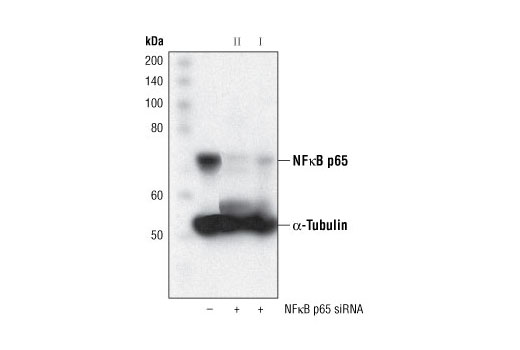 Western blot analysis of extracts from HeLa cells, transfected with 100 nM SignalSilence ® Control siRNA (Fluorescein Conjugate) #6201 (-), SignalSilence ® NF-κB p65 siRNA II (+), or SignalSilence ® NF-κB p65 siRNA I #6261 (+), using NF-κB p65 (C22B4) Rabbit mAb #4764 and α-Tubulin (11H10) Rabbit mAb #2125. NF-κB p65 (C22B4) Rabbit mAb confirms silencing of NF-κB p65 and α-Tubulin (11H10) Rabbit mAb is used to control for loading and specificity of NF-κB p65 siRNA.
