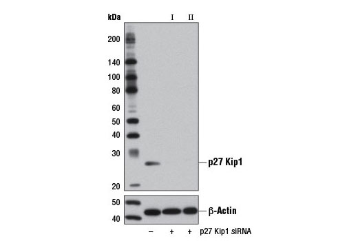 Western blot analysis of extracts from HeLa cells, transfected with 100 nM SignalSilence ® Control siRNA (Unconjugated) #6568 (-), SignalSilence ® p27 Kip1 siRNA I (+), or SignalSilence ® p27 Kip1 siRNA II #12410 (+), using p27 Kip1 (D69C12) XP ® Rabbit mAb #3686 (upper) or β-Actin (D6A8) Rabbit mAb #8457 (lower). The p27 Kip1 (D69C12) XP ® Rabbit mAb confirms silencing of p27 Kip1 expression, while the β-Actin (D6A8) Rabbit mAb is used as a loading control.