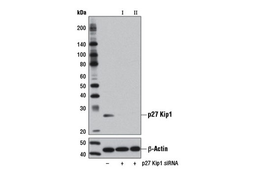 Western blot analysis of extracts from HeLa cells, transfected with 100 nM SignalSilence ® Control siRNA (Unconjugated) #6568 (-), SignalSilence ® p27 Kip1 siRNA I #12324 (+), or SignalSilence ® p27 Kip1 siRNA II (+), using p27 Kip1 (D69C12) XP ® Rabbit mAb #3686 (upper) or β-Actin (D6A8) Rabbit mAb #8457 (lower). The p27 Kip1 (D69C12) XP ® Rabbit mAb confirms silencing of p27 Kip1 expression, while the β-Actin (D6A8) Rabbit mAb is used as a loading control.