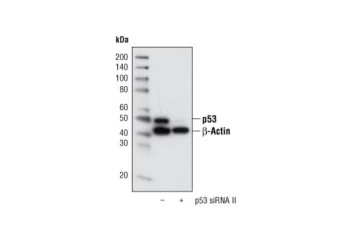 Western blot analysis of extracts from HeLa cells, transfected with 100 nM SignalSilence ® Control siRNA (Fluorescein Conjugate) #6201 (-) or SignalSilence ® p53 siRNA II (+), using p53 (1C12) Mouse mAb #2524 and β-Actin (13E5) Rabbit mAb #4970. p53 (1C12) Mouse mAb confirms silencing of p53 expression and β-Actin (13E5) Rabbit mAb is used to control for loading and specificity of p53 siRNA.