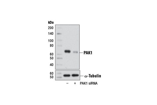 Western blot analysis of extracts from NIH/3T3 cells, transfected with 100 nM SignalSilence ® Control siRNA (Unconjugated) #6568 (-) or SignalSilence ® PAK1 siRNA I (Mouse Specific) (+), using PAK1 Antibody #2602 (upper) or α-Tubulin (11H10) Rabbit mAb #2125 (lower). The PAK1 Antibody confirms silencing of PAK1 expression, while the α-Tubulin (11H10) Rabbit mAb is used as a loading control.