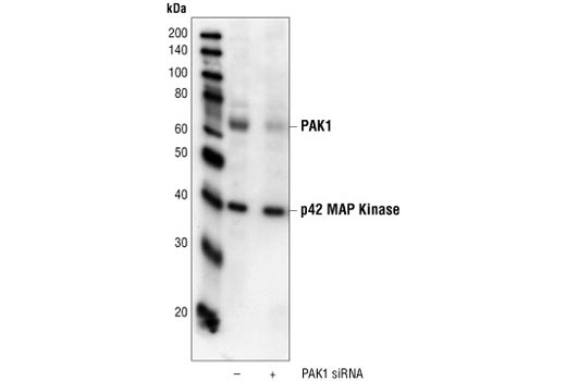 Western blot analysis of extracts from HeLa cells, transfected with 100 nM SignalSilence ® Control siRNA (Fluorescein Conjugate) #6201 (-) or SignalSilence ® PAK1 siRNA I (+), using PAK1 Antibody #2602 and p42 MAP Kinase (Erk2) Antibody #9108. The PAK1 antibody confirms silencing of PAK1 expression, while the p42 MAP kinase antibody is used to control for loading and specificity of PAK1 siRNA.