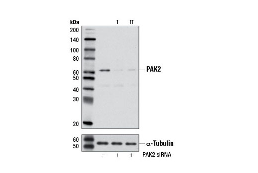 Western blot analysis of extracts from HeLa cells, transfected with 100 nM SignalSilence ® Control siRNA (Unconjugated) #6568 (-), SignalSilence ® PAK2 siRNA I (+) or SignalSilence ® PAK2 siRNA II #6507 (+), using PAK2 (C17A10) Rabbit mAb #2615 and α-Tubulin (11H10) Rabbit mAb #2125. The PAK2 (C17A10) Rabbit mAb confirms silencing of PAK2 expression, while the α-Tubulin (11H10) Rabbit mAb is used as a loading control.
