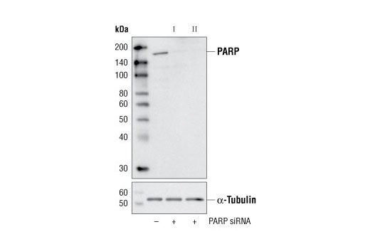 Western blot analysis of extracts from HeLa cells, transfected with 100 nM SignalSilence ® Control siRNA (Unconjugated) #6568 (-), SignalSilence ® PARP siRNA I (+) or SignalSilence ® PARP siRNA II #6305 (+), using PARP (46D11) Rabbit mAb #9532 (upper) or α-Tubulin (11H10) Rabbit mAb #2125 (lower). The PARP (46D11) Rabbit mAb confirms silencing of PARP expression, while the α-Tubulin (11H10) Rabbit mAb is used as a loading control.