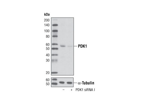 Western blot analysis of extracts from K-562 cells, transfected with 100 nM SignalSilence ® Control siRNA (Unconjugated) #6568 (-) or SignalSilence ® PDK1 siRNA I (+), using PDK1 (D37A7) Rabbit mAb #5662 and α-Tubulin (11H10) Rabbit mAb #2125. The PDK1 (D37A7) Rabbit mAb confirms silencing of PDK1 expression, while the α-Tubulin (11H10) Rabbit mAb is used as a loading control.