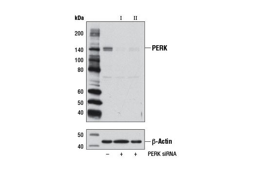 Western blot analysis of extracts from 293T cells, transfected with 100 nM SignalSilence ® Control siRNA (Unconjugated) #6568 (-), SignalSilence ® PERK siRNA I #9024 (+), or SignalSilence ® PERK siRNA II (+), using PERK (C33E10) Rabbit mAb #3192 (upper) or β-Actin (D6A8) Rabbit mAb #8457 (lower). The PERK (C33E10) Rabbit mAb confirms silencing of PERK expression, while the β-Actin (D6A8) Rabbit mAb is used as a loading control.