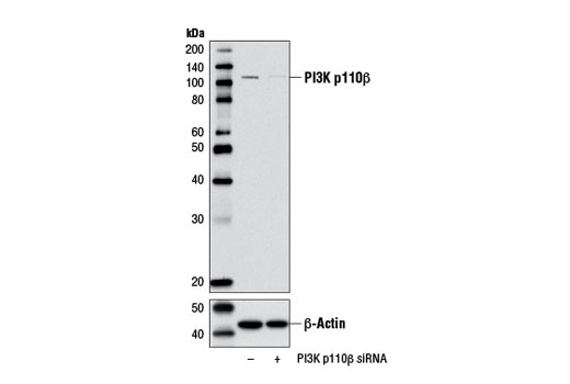 Western blot analysis of extracts from MCF7 cells, transfected with 100 nM SignalSilence ® Control siRNA (Unconjugated) #6568 (-) or SignalSilence ® PI3 Kinase p110β siRNA I (+), using PI3 Kinase p110β (C73F8) Rabbit mAb #3011 and β-Actin (D6A8) Rabbit mAb #8457. The PI3 Kinase p110β (C73F8) Rabbit mAb antibody confirms silencing of PI3 Kinase p110β expression while the β-Actin (D6A8) Rabbit mAb is used as a loading control.