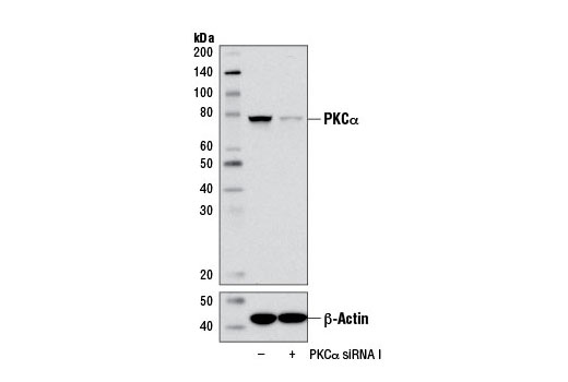 Western blot analysis of extracts from HeLa cells, transfected with 100 nM SignalSilence ® Control siRNA (Unconjugated) #6568 (-) or SignalSilence ® PKCα siRNA I (+), using PKCα Antibody #2056 (upper) or β-Actin (D6A8) Rabbit mAb #8457 (lower). The PKCα Antibody confirms silencing of PKCα expression, while the β-Actin (D6A8) Rabbit mAb is used as a loading control.