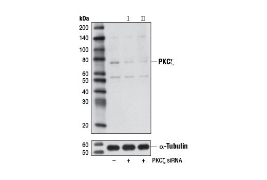Western blot analysis of extracts from HeLa cells, transfected with 100 nM SignalSilence ® Control siRNA (Unconjugated) #6568 (-), SignalSilence ® PKCζ siRNA I #8672 (+), or SignalSilence ® PKCζ siRNA II (+), using PKCζ (C24E6) Rabbit mAb #9368 (upper) or α-Tubulin (11H10) Rabbit mAb #2125 (lower). The PKCζ (C24E6) Rabbit mAb confirms silencing of PKCζ expression, while the α-Tubulin (11H10) Rabbit mAb is used as a loading control.