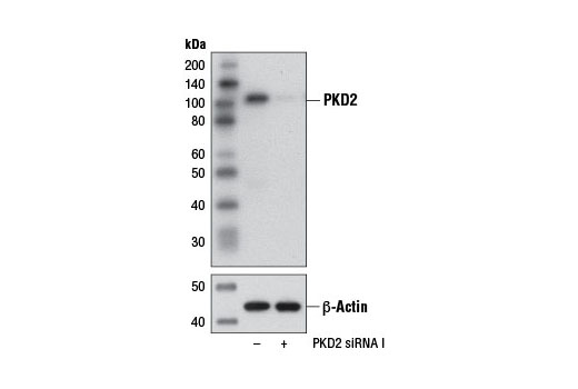 Western blot analysis of extracts from PANC-1 cells, transfected with 100 nM SignalSilence ® Control siRNA (Unconjugated) #6568 (-) or SignalSilence ® PKD2 siRNA I (+), using PKD2 (D1A7) Rabbit mAb #8188 (upper) or β-Actin (D6A8) Rabbit mAb #8457 (lower). The PKD2 (D1A7) Rabbit mAb confirms silencing of PKD2 expression, while the β-Actin (D6A8) Rabbit mAb is used as a loading control.