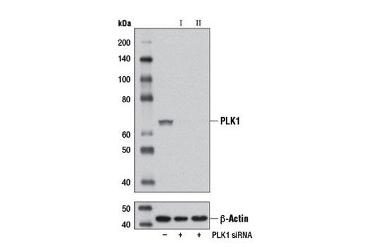 Western blot analysis of extracts from HeLa cells, transfected with 100 nM SignalSilence ® Control siRNA (Unconjugated) #6568 (-), SignalSilence ® PLK1 siRNA I (+), or SignalSilence ® PLK1 siRNA II #12132 (+), using PLK1 (208G4) Rabbit mAb #4513 (upper) or β-Actin (D6A8) Rabbit mAb #8457 (lower). The PLK1 (208G4) Rabbit mAb confirms silencing of PLK1 expression, while the β-Actin (D6A8) Rabbit mAb is used as a loading control.