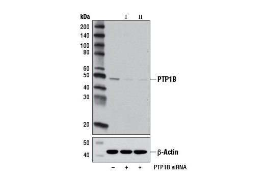 Western blot analysis of extracts from HeLa cells, transfected with SignalSilence ® Control siRNA (unconjugated) #6568 (-), SignalSilence ® PTP1B siRNA I (+) or SignalSilence ® PTP1B siRNA II #13380 (+), using PTP1B Antibody #5311 (upper) or β-Actin (D8A6) Rabbit mAb #8457 (lower). The PTP1B Antibody confirms silencing of PTP1B expression, while the β-Actin (D8A6) Rabbit mAb is used as a loading control.