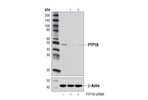 Western blot analysis of extracts from HeLa cells, transfected with SignalSilence ® Control siRNA (unconjugated) #6568 (-), SignalSilence ® PTP1B siRNA I #13348 (+) or SignalSilence ® PTP1B siRNA II (+), using PTP1B Antibody #5311 (upper) or β-Actin (D8A6) Rabbit mAb #8457 (lower). The PTP1B Antibody confirms silencing of PTP1B expression, while the β-Actin (D8A6) Rabbit mAb is used as a loading control.