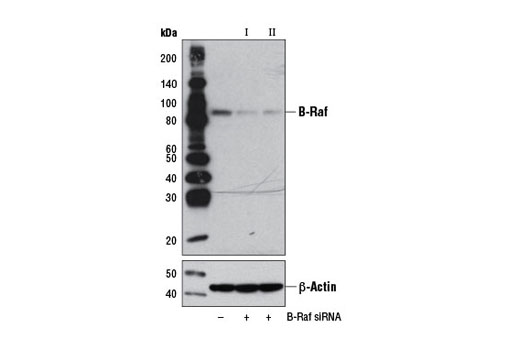 Western blot analysis of extracts from HT-29 cells, transfected with 100 nM SignalSilence ® Control siRNA (Unconjugated) #6568 (-), SignalSilence ® B-Raf siRNA I (+), or SignalSilence ® B-Raf siRNA II #9439 (+), using B-Raf (55C6) Rabbit mAb #9433 (upper) or β-Actin (D6A8) Rabbit mAb #8457 (lower). The B-Raf (55C6) Rabbit mAb confirms silencing of B-Raf expression, while the β-Actin (D6A8) Rabbit mAb is used as a loading control.