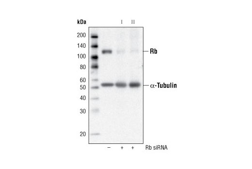 Western blot analysis of extracts from 293 cells, transfected with control (-) or SignalSilence ® Rb siRNA I (+), using Rb (4H1) Mouse mAb #9309 and p44/42 MAPK (Erk1/2) (3A7) Mouse mAb #9107. The Rb antibody confirms silencing of Rb expression, while the p42 MAPK antibody is used to control for loading and specificity of Rb siRNA.