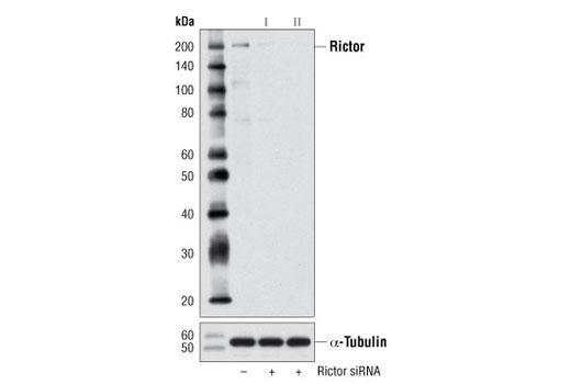Western blot analysis of extracts from 293 cells, transfected with 100 nM SignalSilence ® Control siRNA (Unconjugated) #6568 (-), SignalSilence ® Rictor siRNA I #8649 (+), or SignalSilence ® Rictor siRNA II (+), using Rictor (53A2) Rabbit mAb #2114 (upper) or α-Tubulin (11H10) Rabbit mAb #2125 (lower). The Rictor (53A2) Rabbit mAb confirms silencing of rictor expression, while the α-Tubulin (11H10) Rabbit mAb is used as a loading control.