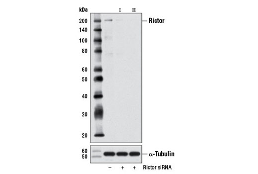 Western blot analysis of extracts from 293 cells, transfected with 100 nM SignalSilence ® Control siRNA (Unconjugated) #6568 (-), SignalSilence ® Rictor siRNA I (+), or SignalSilence ® Rictor siRNA II #8622 (+), using Rictor (53A2) Rabbit mAb #2114 (upper) or α-Tubulin (11H10) Rabbit mAb #2125 (lower). The Rictor (53A2) Rabbit mAb confirms silencing of rictor expression, while the α-Tubulin (11H10) Rabbit mAb is used as a loading control.