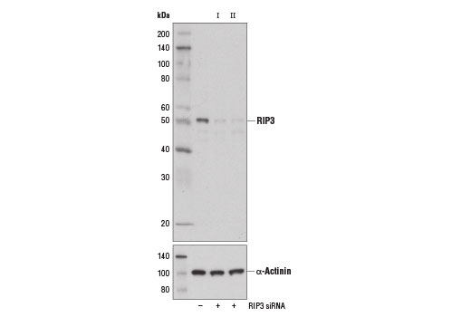 Western blot analysis of extracts from L-929 cells, transfected with 100 nM SignalSilence ® Control siRNA (Unconjugated) #6568 (-), SignalSilence ® RIP3 siRNA I (Mouse Specific) #14645 (+), or SignalSilence ® RIP3 siRNA II (Mouse Specific) (+), using RIP3 Antibody (Rodent Specific) #14401 (upper) and α-Actinin (D6F6) XP ® Rabbit mAb #6487 (lower). The RIP3 Antibody (Rodent Specific) confirms silencing of RIP3 expression, while the α-Actinin (D6F6) XP ® Rabbit mAb is used as a loading control.
