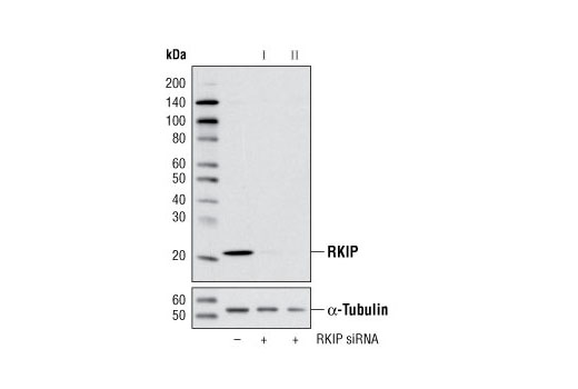 Western blot analysis of extracts from HeLa cells, transfected with 100 nM SignalSilence ® Control siRNA (Unconjugated) #6568 (-), SignalSilence ® RKIP siRNA I #6296 (+) or SignalSilence ® RKIP siRNA II (+), using RKIP (V177) Antibody #5291 (upper) or α-Tubulin (11H10) Rabbit mAb #2125 (lower). The RKIP (V177) Antibody confirms silencing of RKIP expression, while the α-Tubulin (11H10) Rabbit mAb is used as a loading control.