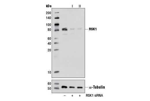 Western blot analysis of extracts from 293 cells, transfected with 100 nM SignalSilence ® Control siRNA (Unconjugated) #6568 (-), SignalSilence ® RSK1 siRNA I #6309 (+) or SignalSilence ® RSK1 siRNA II (+), using RSK1 Antibody #9333 (upper) or α-Tubulin (11H10) Rabbit mAb #2125 (lower). The RSK1 Antibody confirms silencing of RSK1 expression, while the α-Tubulin (11H10) Rabbit mAb is used as a loading control.