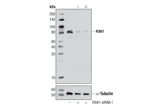 Western blot analysis of extracts from 293 cells, transfected with 100 nM SignalSilence ® Control siRNA (Unconjugated) #6568 (-), SignalSilence ® RSK1 siRNA I (+) or SignalSilence ® RSK1 siRNA II #6313 (+), using RSK1 Antibody #9333 (upper) or α-Tubulin (11H10) Rabbit mAb #2125 (lower). The RSK1 Antibody confirms silencing of RSK1 expression, while the α-Tubulin (11H10) Rabbit mAb is used as a loading control.