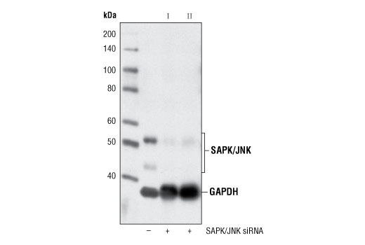 Western blot analysis of extracts from HeLa cells, transfected with 100 nM SignalSilence ® Control siRNA (Unconjugated) #6568 (-), SignalSilence ® SAPK/JNK siRNA I (+) or SignalSilence ® SAPK/JNK siRNA II #6233 (+), using SAPK/JNK (56G8) Rabbit mAb #9258 and GAPDH (14C10) Rabbit mAb #2118. The SAPK/JNK antibody confirms silencing of SAPK/JNK expression and GAPDH (14C10) rabbit mAb is used to control for loading and specificity of SAPK/JNK siRNA.