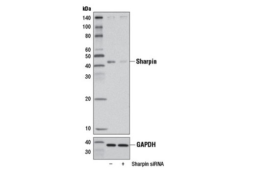 Western blot analysis of extracts from 293T cells, transfected with 100 nM SignalSilence ® Control siRNA (Unconjugated) #6568 (-) or SignalSilence ® Sharpin siRNA I (+), using Sharpin (D4P5B) Rabbit mAb #12541 (upper) or GAPDH (D16H11) XP ® Rabbit mAb #5174 (lower). The Sharpin (D4P5B) Rabbit mAb confirms silencing of sharpin expression, while the GAPDH (D16H11) XP ® Rabbit mAb is used as a loading control.