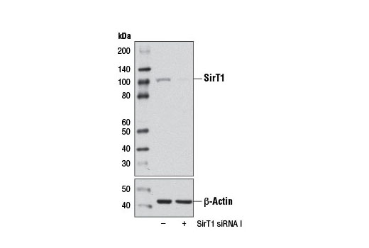 Western blot analysis of extracts from 293T cells, transfected with 100 nM SignalSilence ® Control siRNA (Unconjugated) #6568 (-) or SignalSilence ® SirT1 siRNA I (+), using SirT1 (D1D7) Rabbit mAb #9475 (upper) or β-Actin (D6A8) Rabbit mAb #8457 (lower). The SirT1 (D1D7) Rabbit mAb confirms silencing of SirT1 expression, while the β-Actin (D6A8) Rabbit mAb is used as a loading control.