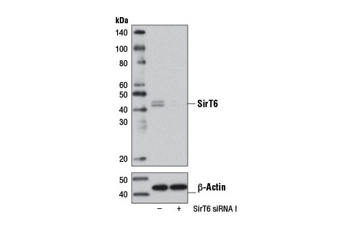 Western blot analysis of extracts from HeLa cells, transfected with 100 nM SignalSilence ® Control siRNA (Unconjugated) #6568 (-) or SignalSilence ® SirT6 siRNA I (+), using SirT6 (D10A4) Rabbit mAb #8771 (upper) or β-Actin (D6A8) Rabbit mAb #8457 (lower). The SirT6 (D10A4) Rabbit mAb confirms silencing of SirT6 expression, while the β-Actin (D6A8) Rabbit mAb is used as a loading control.