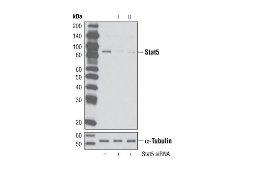Western blot analysis of extracts from HeLa cells, transfected with 100 nM SignalSilence ® Control siRNA (Unconjugated) #6568 (-), SignalSilence ® Stat5 siRNA I #6275 (+), or SignalSilence ® Stat5 siRNA II (+), using Stat5 (3H7) Rabbit mAb #9358 (upper) or α-Tubulin (11H10) Rabbit mAb #2125 (lower). The Stat5 (3H7) Rabbit mAb confirms silencing of Stat5 expression, while the α-Tubulin (11H10) Rabbit mAb is used as a loading control.