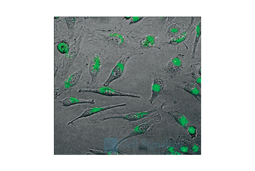 Fluorescent detection of SignalSilence ® Control siRNA (Fluorescein Conjugate) #6201 in living HeLa cells 24 hours post-transfection, demonstrating nearly 100% transfection efficiency.