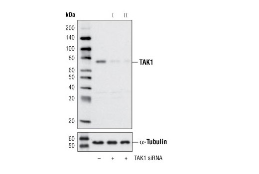 Western blot analysis of extracts from 293 cells, transfected with 100 nM SignalSilence ® Control siRNA (Unconjugated) #6568 (-), SignalSilence ® TAK1 siRNA I #6317 (+) or SignalSilence ® TAK1 siRNA II (+), using TAK1 Antibody #4505 (upper) or α-Tubulin (11H10) Rabbit mAb #2125 (lower). The TAK1 Antibody confirms silencing of TAK1 expression, while the α-Tubulin (11H10) Rabbit mAb is used as a loading control.