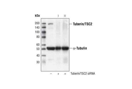 Western blot analysis of extracts from HeLa cells, transfected with 100 nM SignalSilence ® Control siRNA (Fluorescein Conjugate) #6201 (-) or SignalSilence ® Tuberin/TSC2 siRNA I #6476 or SignalSilence ® Tuberin/TSC2 siRNA II (+), using Tuberin/TSC2 (28A7) Rabbit mAb #3635 and α-Tubulin (11H10) Rabbit mAb #2125. Tuberin/TSC2 (28A7) Rabbit mAb confirms silencing of Tuberin/TSC2 expression and α-Tubulin (11H10) Rabbit mAb is used to control for loading and specificity of Tuberin/TSC2 siRNA.