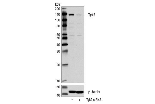 Western blot analysis of extracts from MCF7 cells, transfected with 100 nM SignalSilence ® Control siRNA (Unconjugated) #6568 (-), or SignalSilence ® Tyk2 siRNA I (+), using Tyk2 (D4I5T) Rabbit mAb #14193 (upper) or β-Actin (D6A8) Rabbit mAb #8457 (lower). The Tyk2 (D4I5T) Rabbit mAb confirms silencing of Tyk2 expression, while the β-Actin (D6A8) Rabbit mAb is used as a loading control.